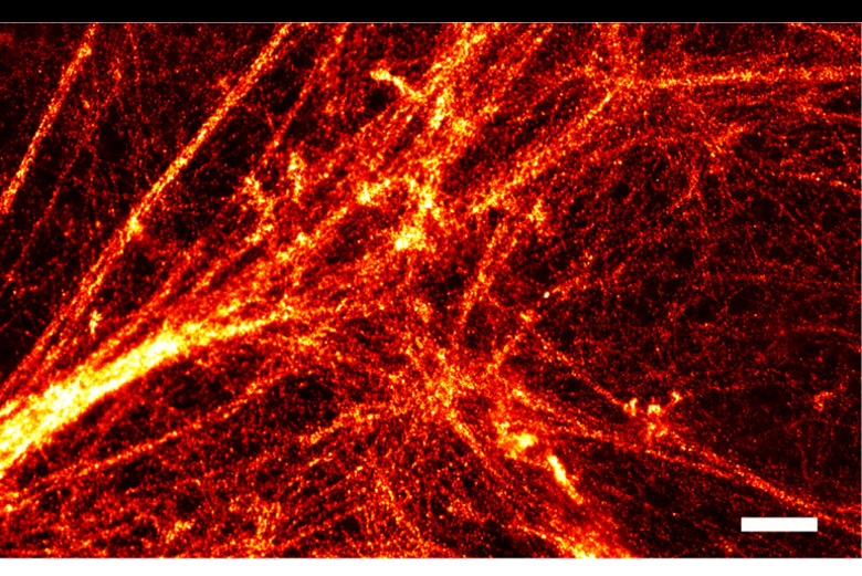 A Bayesian multi-emitter (BAMF) super-resolution reconstruction of the actin cytoskeleton